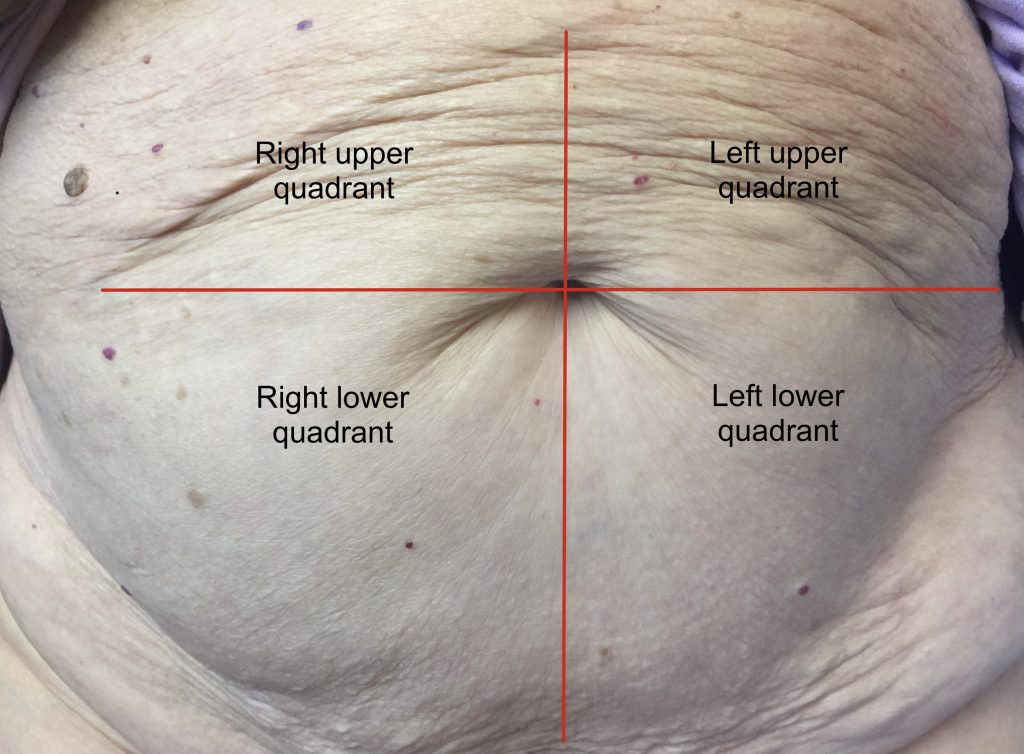 A person's naked abdomen divided into four quadrants with red line: right upper, left upper, right lower, and left lower quadrants.