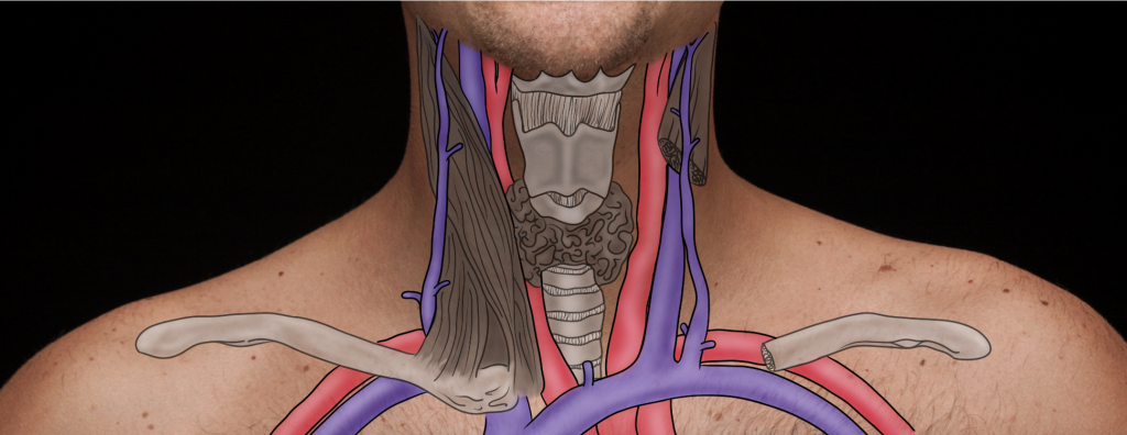 A man's neck with the jugular veins, carotid arteries, muscles, trachea and clavicle drwwn on top of the body.