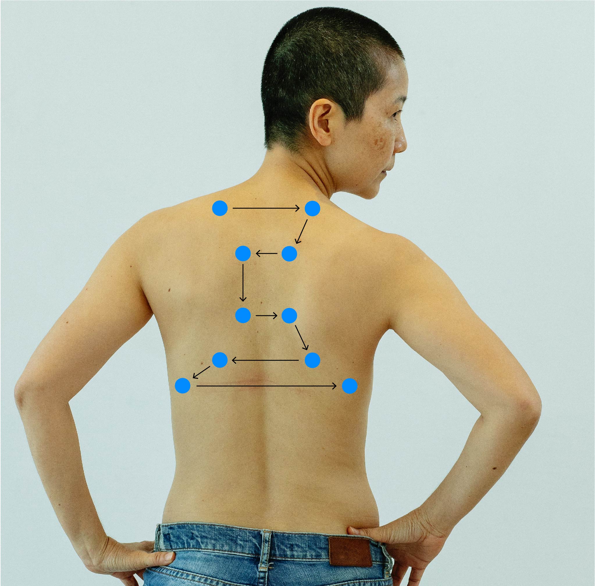 A person's posterior chest/thorax naked with blue dots drawn on top in the pattern of tactile fremitus.