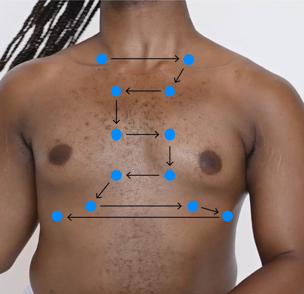 An anterior chest naked with blue dots to mark the pattern of auscultation.