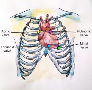 A drawing of the human rib cage with the heart identifying the various heart valves: aortic, pulmonic, tricuspid, and mitral.