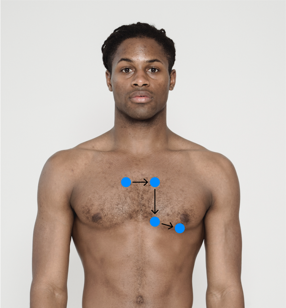 Blue dots outlining the auscultation sites on a person's chest.