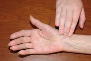 Healthcare provider placing fingers along the radial bone near the flexor aspect of wrist to correctly measure radial pulse